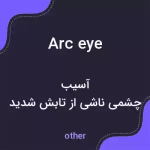 معنی arc eye به فارسی معنی arc eye به فارسی