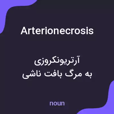 معنی arterionecrosis به فارسی معنی arterionecrosis به فارسی