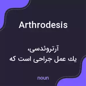 معنی arthrodesis به فارسی معنی arthrodesis به فارسی