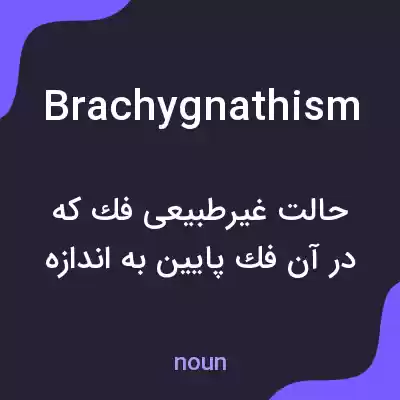 معنی brachygnathism به فارسی معنی brachygnathism به فارسی