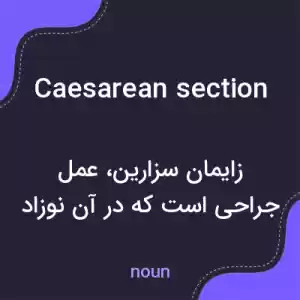 معنی caesarean section به فارسی معنی caesarean section به فارسی
