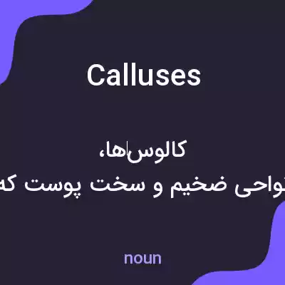 معنی calluses به فارسی معنی calluses به فارسی