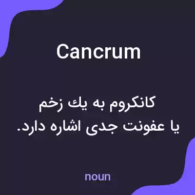 معنی cancrum به فارسی معنی cancrum به فارسی