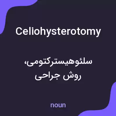 معنی celiohysterotomy به فارسی معنی celiohysterotomy به فارسی