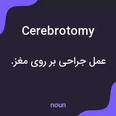 معنی cerebrotomy به فارسی معنی cerebrotomy به فارسی