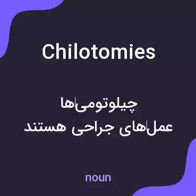 معنی chilotomies به فارسی معنی chilotomies به فارسی