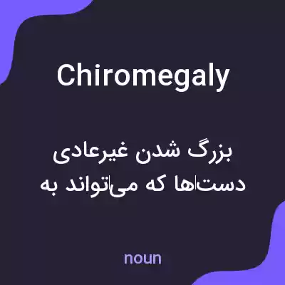 معنی chiromegaly به فارسی معنی chiromegaly به فارسی