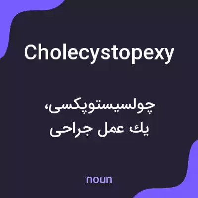 معنی cholecystopexy به فارسی معنی cholecystopexy به فارسی