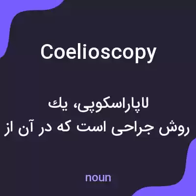 معنی coelioscopy به فارسی معنی coelioscopy به فارسی