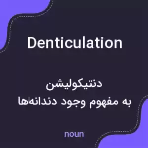 معنی denticulation به فارسی معنی denticulation به فارسی