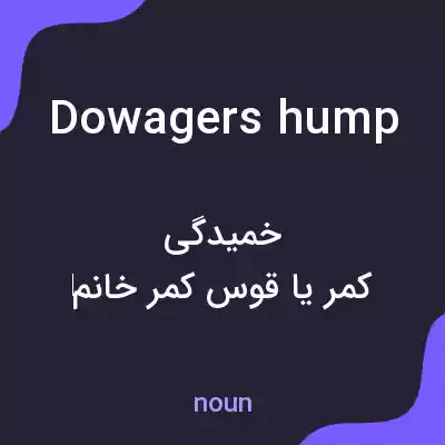 معنی dowagers hump به فارسی معنی dowagers hump به فارسی