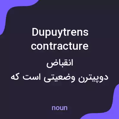 معنی dupuytrens contracture به فارسی معنی dupuytrens contracture به فارسی