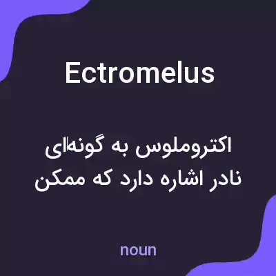 معنی ectromelus به فارسی معنی ectromelus به فارسی