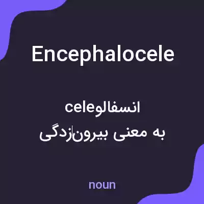 معنی encephalocele به فارسی معنی encephalocele به فارسی