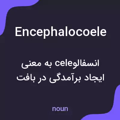 معنی encephalocoele به فارسی معنی encephalocoele به فارسی