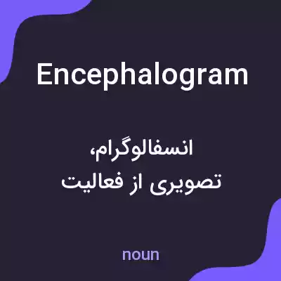 معنی encephalogram به فارسی معنی encephalogram به فارسی