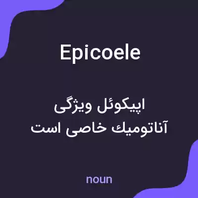 معنی epicoele به فارسی معنی epicoele به فارسی