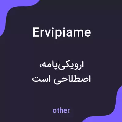 معنی ervipiame به فارسی معنی ervipiame به فارسی