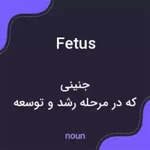 معنی fetus به فارسی معنی fetus به فارسی