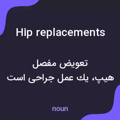 معنی hip replacements به فارسی معنی hip replacements به فارسی