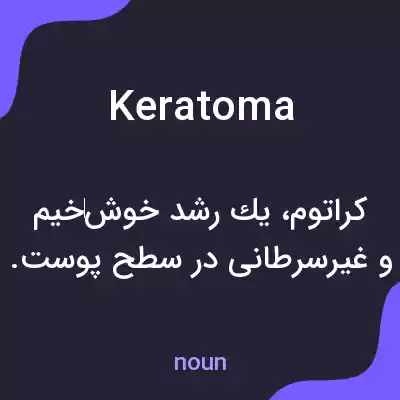 معنی keratoma به فارسی معنی keratoma به فارسی
