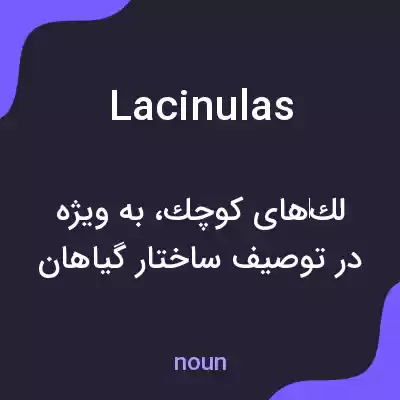معنی lacinulas به فارسی معنی lacinulas به فارسی