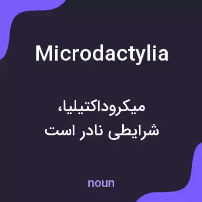 معنی microdactylia به فارسی معنی microdactylia به فارسی