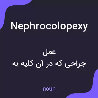 معنی nephrocolopexy به فارسی معنی nephrocolopexy به فارسی