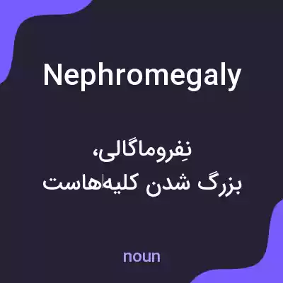 معنی nephromegaly به فارسی معنی nephromegaly به فارسی