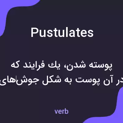 معنی pustulates به فارسی معنی pustulates به فارسی