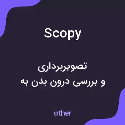 معنی scopy به فارسی معنی scopy به فارسی