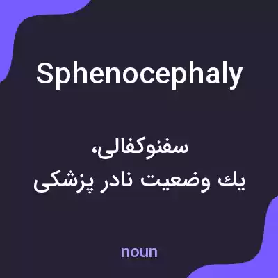 معنی sphenocephaly به فارسی معنی sphenocephaly به فارسی