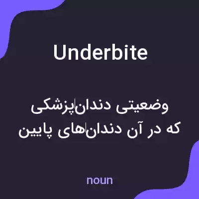 معنی underbite به فارسی معنی underbite به فارسی
