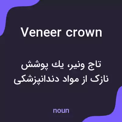 معنی veneer crown به فارسی معنی veneer crown به فارسی